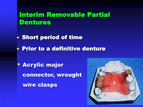 Temporary removable partial dentures | PPT