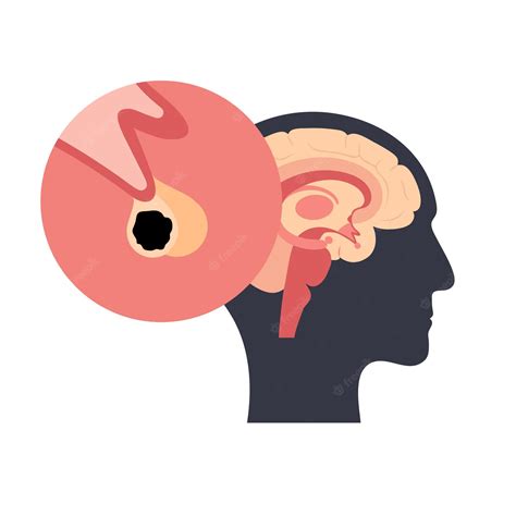 pituitarys #3460672 | Clipart Library