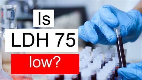 Is LDH 75 low, normal or dangerous? What does Lactate dehydrogenase level 75 mean?