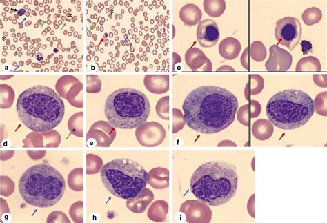 Nucleated Red Blood Cells