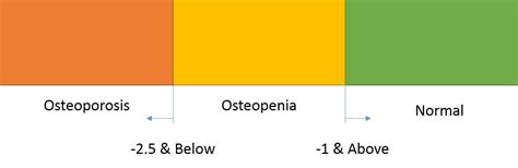 Image result for Dexa Scan Interpretation