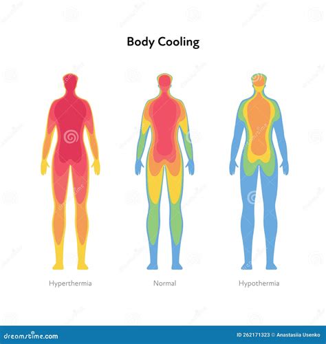 Hyperthermia Vs Hypothermia