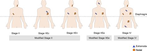 Frontiers | Modified Stage Grouping of Diffuse Large B-Cell Lymphoma Involving the Same Side of ...