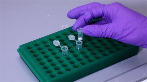 Isolation of RNA From Bacteria 的图像结果