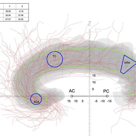 Cingulate Gyrus Function 的图像结果