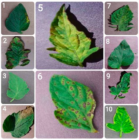 From Pixels to Diagnosis: Implementing and Evaluating a CNN Model for ...