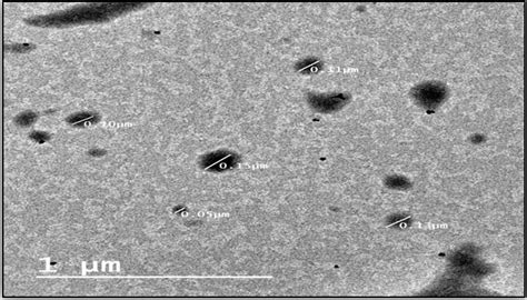 Fig. 3: TEM photomicrograph of the optimum TE formulation (F1)