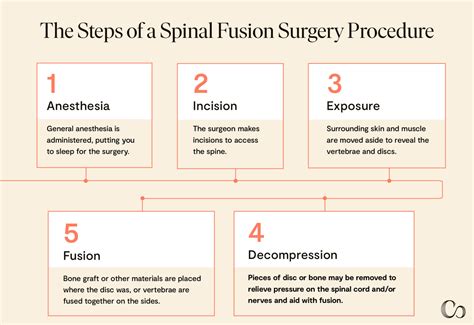 Spinal Fusion 101: Understanding Spinal Fusion Surgery - Commons Clinic