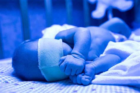 नवजात शिशुओं में पीलिया: लक्षण, कारण, निदान, उपचार और रोकथाम - THIP Media