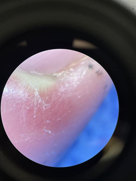Image result for Finger Under Microscope