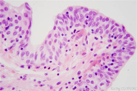 Image result for Transitional Epithelial Cells