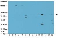 Anti-Choline Acetyltransferase Antibody | AB144P-200UL