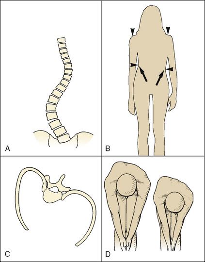 Orthopedic Surgery Anesthesia Management 的图像结果