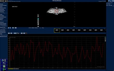 Intensity Contrast 的图像结果