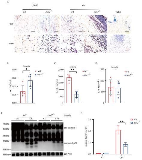 Absent in Melanoma 2 Mediates Inflammasome Signaling Activation against ...