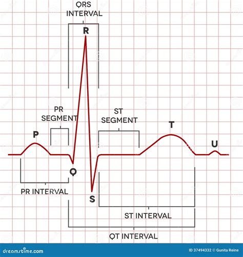 Human Heart Normal Sinus Rhythm, Electrocardiogram Stock Vector ...