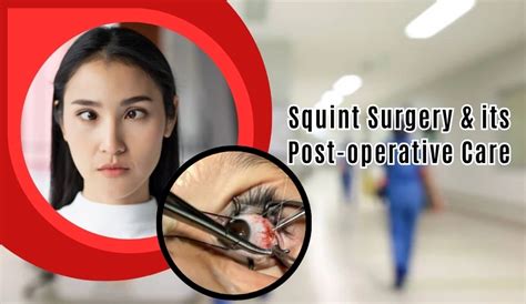 Squint surgery and post operative Care
