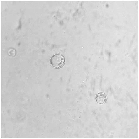 莲叶 的图像结果