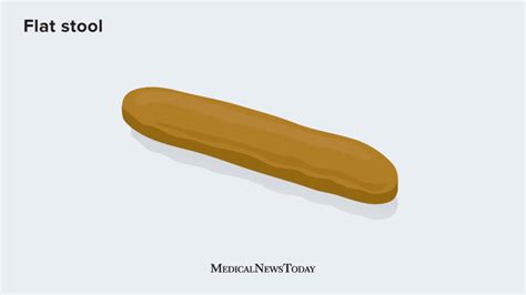 Flat poop: Causes, home treatment, when to see a doctor