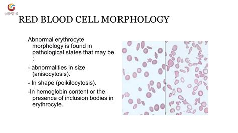 Abnormal morphology of rbc notes | PDF