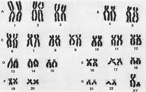 Image result for karyotypes