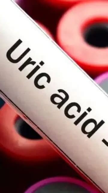 10 Fastest ways to lower your uric acid level naturally
