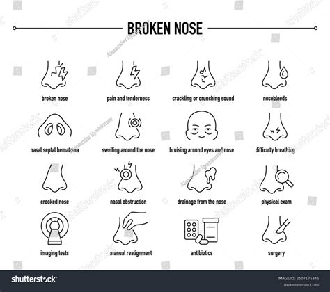 1,330 Broken Nose Trauma Royalty-Free Images, Stock Photos & Pictures | Shutterstock