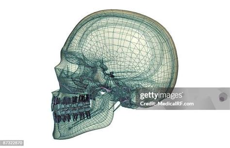 Process Bone 的图像结果