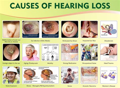 Hearing aid: WHAT ARE THE SYMPTOMS OF HEARING LOSS?