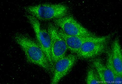 SDSL antibody (16242-1-AP) | Proteintech