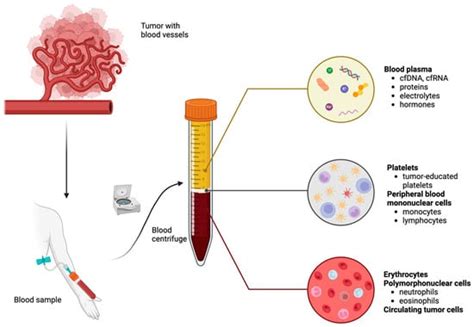 Melanoma’s New Frontier: Exploring the Latest Advances in Blood-Based ...