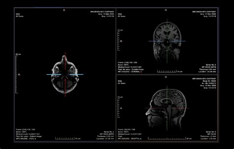 AI diagnostic imaging: How is transforming medical care? - Quibim