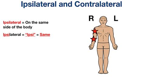 Image result for Contralateral Body Parts Example