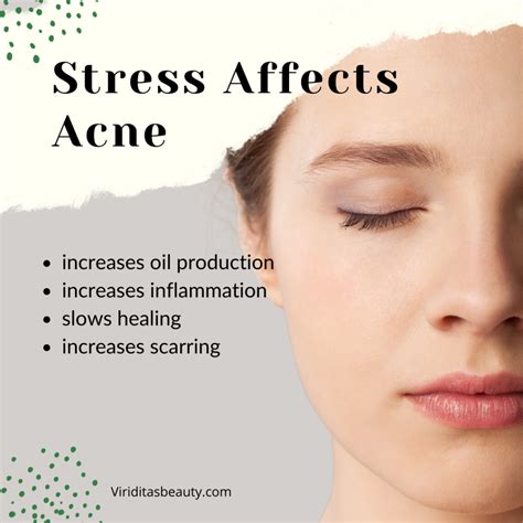 How Stress Causes Acne: What You Need To Know - Viriditas Beauty