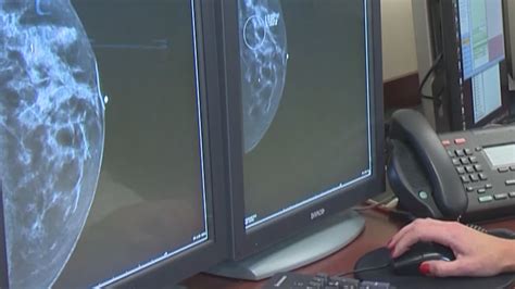 Free breast cancer screenings in Pasco County | wtsp.com