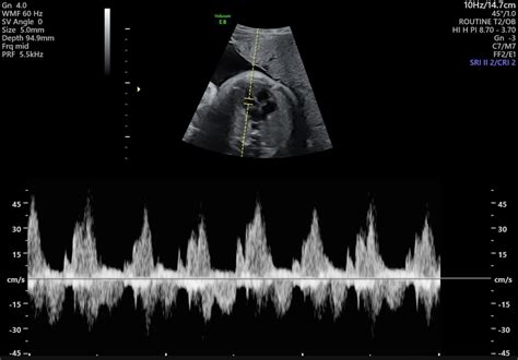 Growth Scans — Trinity Imaging