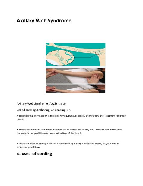 Axillary Web Syndrome