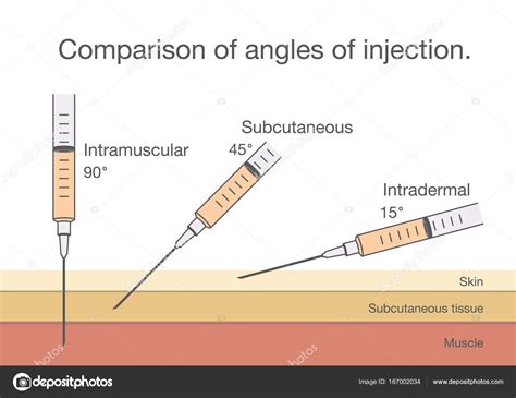Angle of Injection 的图像结果