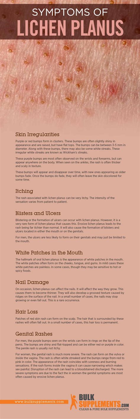 Vulvar Lichen Planus