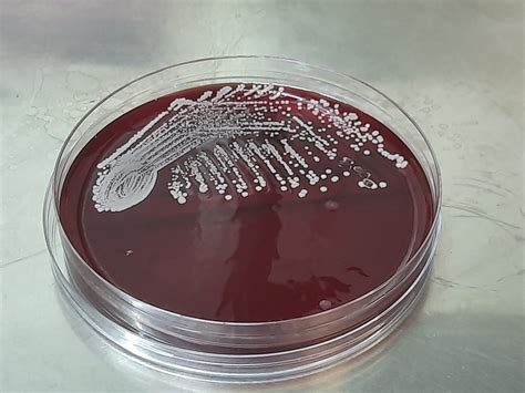 Staphylococcus hominis: Introduction, Morphology, Pathogenicity
