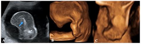 Diagnostics | Special Issue : Obstetric Ultrasound: The Most Patient ...