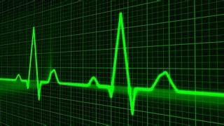 Image result for Game Development Debugging Monitoring Software Reddit