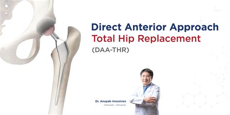 Direct Anterior Approach Total Hip Replacement (DAA-THR) | Bangkok ...