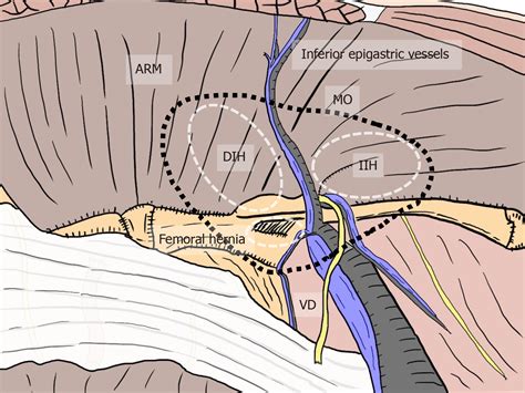 Human Anatomy Groin