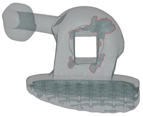 Nanotomographic Analysis of Orthodontic Molar Tubes for Direct Bonding
