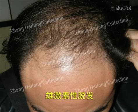 Autoadrogynephilia 的图像结果