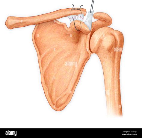 Coracoacromial Ligament High Resolution Stock Photography and Images - Alamy