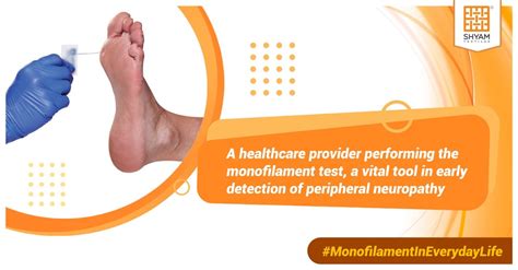 Monofilament test: vital for early peripheral neuropathy detection
