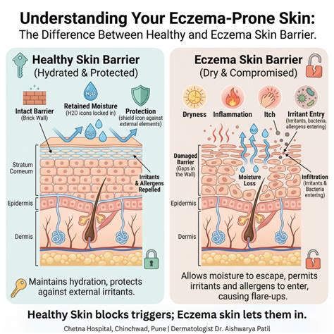 Eczema skin Treatment in Chinchwad | Expert Care