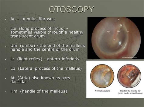 Image result for Transillumination Normal Head